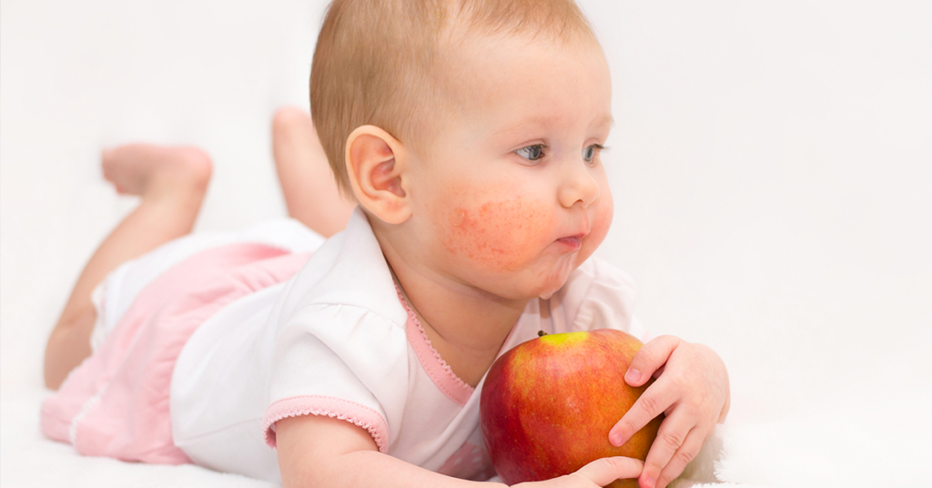 Milyen gyakori az atópiás dermatitisz?