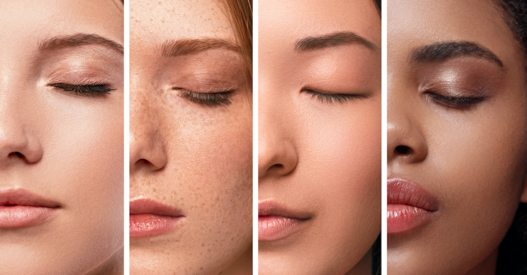 A különböző bőrtípusú embereket eltérő mértékben veszélyezteti az UV-sugárzás és a melanoma kockázata, ahogy a leégés veszélye is.